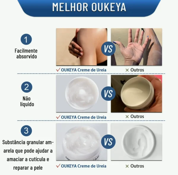 Urea Cream 40% for Foot & Hand Care