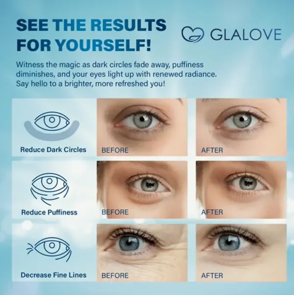Under-Eye Patches for Puffy Eyes, 60 Pieces Retinol Gels Treatment