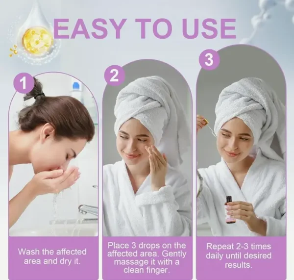 Stye Eye Treatment, Fast Relief Solution, 30ML