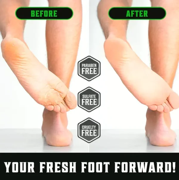 Tea Tree Feet Cream for Dry Heels Featuring Mint (8oz)