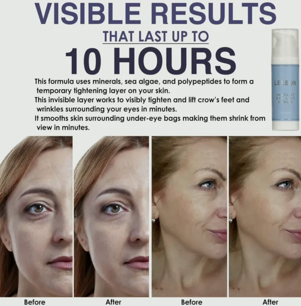 Instant Eye Lift Treatment - Immediate Results for Wrinkle Reduction