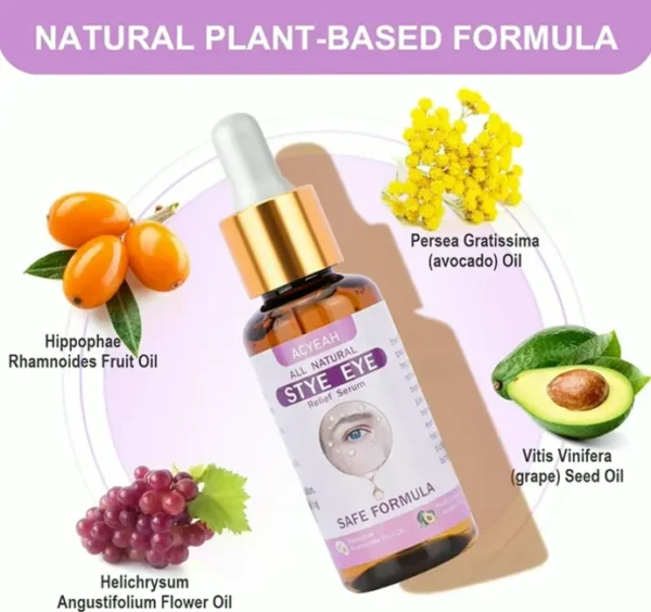 Stye Eye Treatment, Fast Relief Solution, 30ML