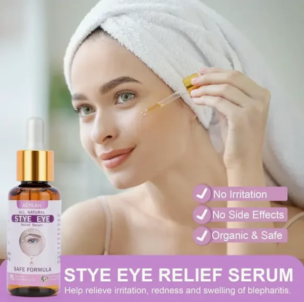 Stye Eye Treatment, Fast Relief Solution, 30ML