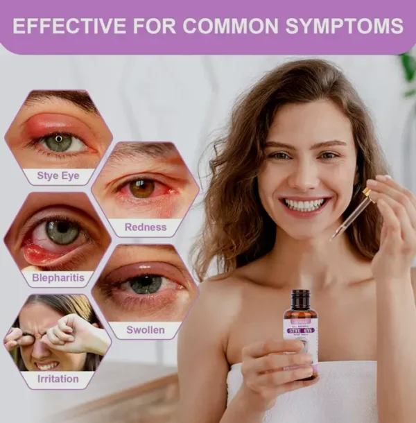 Stye Eye Treatment, Fast Relief Solution, 30ML
