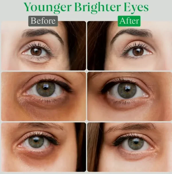BrightEyes Caffeine Eye Cream for Puffy Eyes (Unisex) - 1 Oz