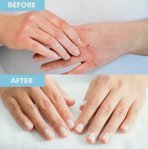 Top-Quality Hand & Foot Moisturizing Treatment Set